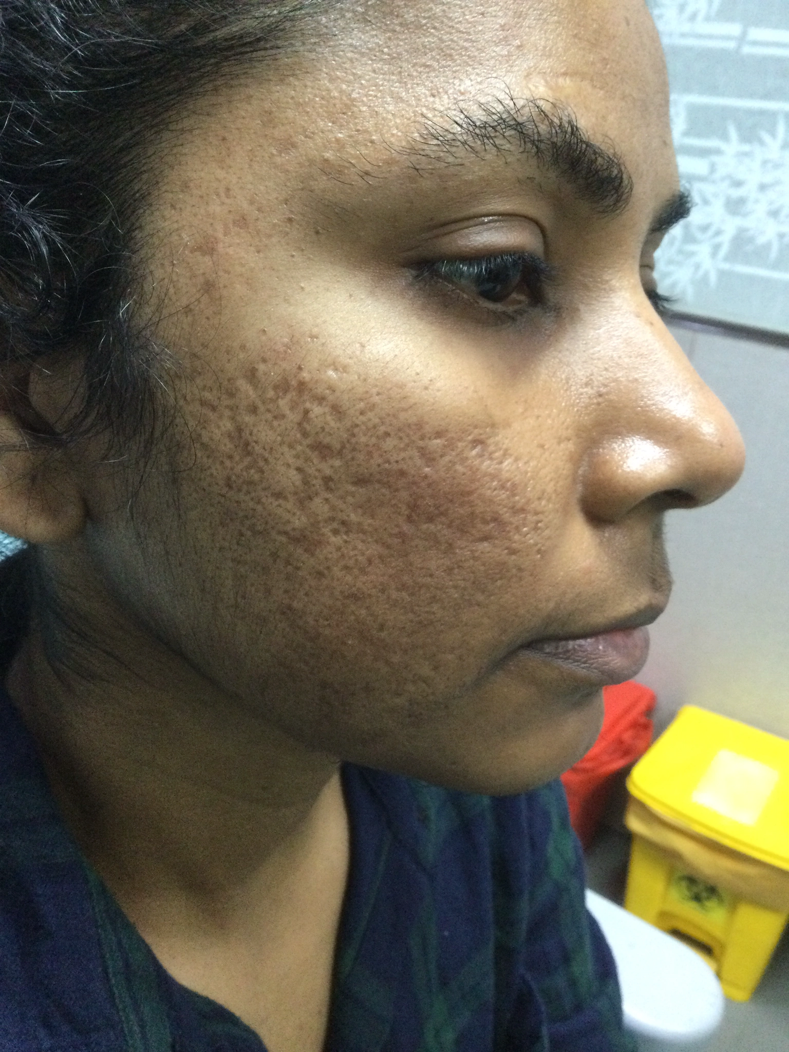 Co2 Fractional before, Client 1