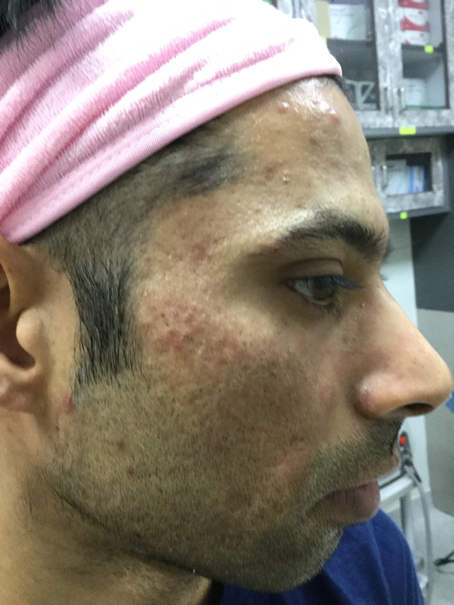 Co2 Fractional before, Client 2