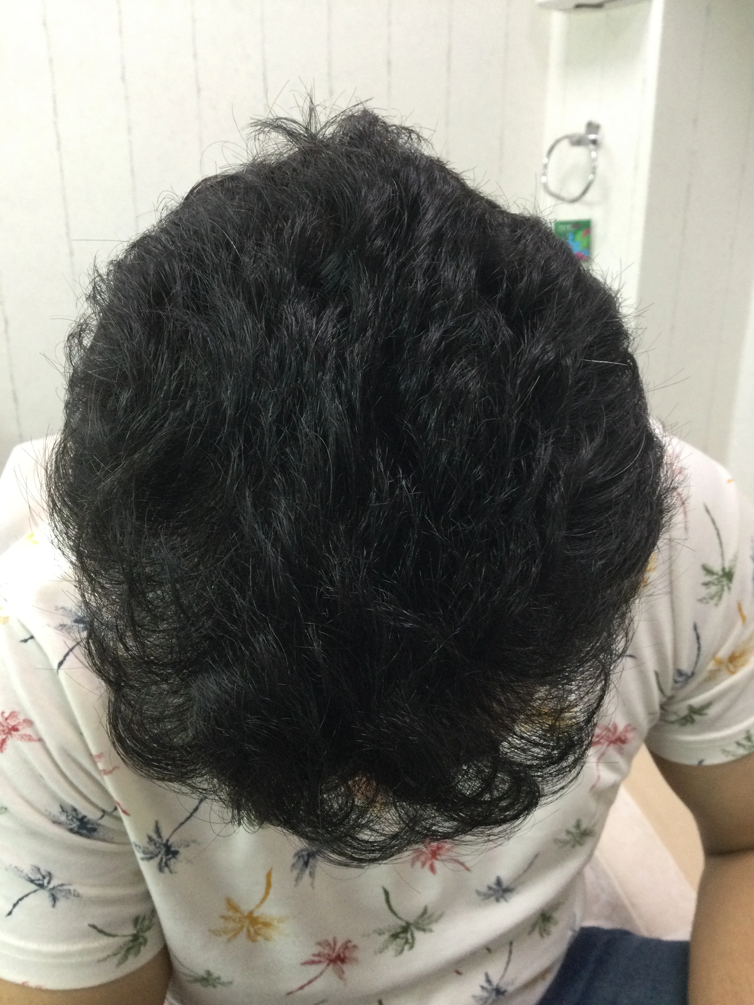 Hair PRP after, Client 1